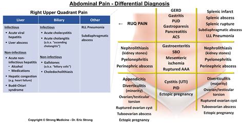 Causes Of Right Upper Quadrant Pain