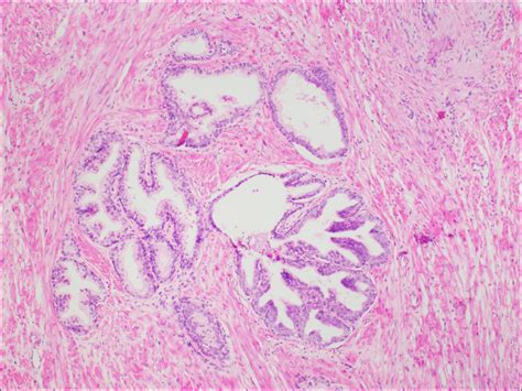 Prostate – Normal Histology – NUS Pathweb :: NUS Pathweb