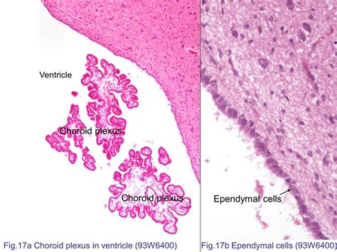 Choroid Plexus Histology