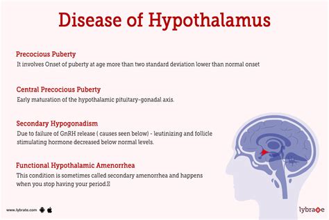 Hypothalamus (Human Anatomy): Picture, Functions, Diseases, and Treatments