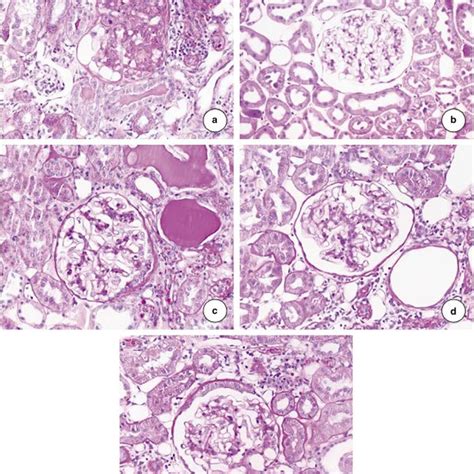 Representative sections of the kidney (PAS stain, magnification Â 200).... | Download Scientific ...