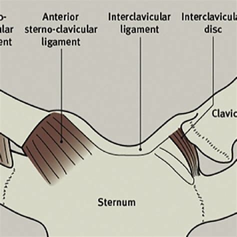 Reattachment of the anterior sternoclavicular ligament. (a) Showing ...