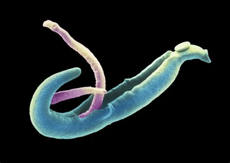 Why 17 People Volunteered to Be Infected with Parasitic Worms | Live ...