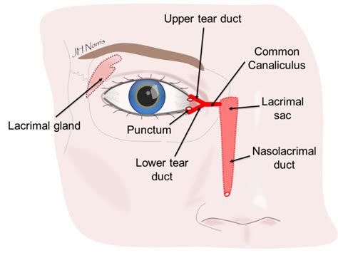 DCR (watery eye) surgery - Jonathan Norris