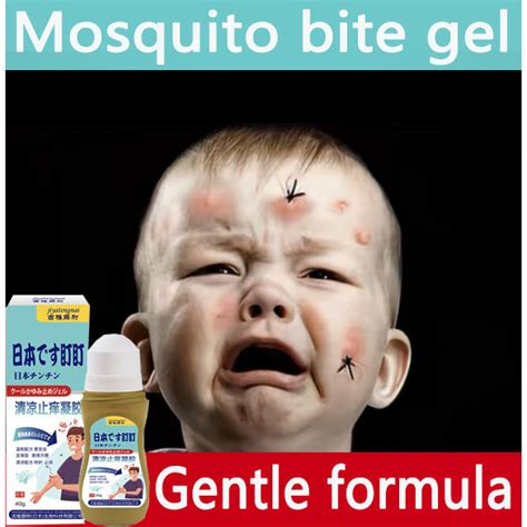 Mosquitoes Bites Ointment After Insect bites, for Scratches, Bumps ...