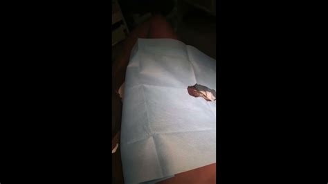 Under arm abscess removed - YouTube