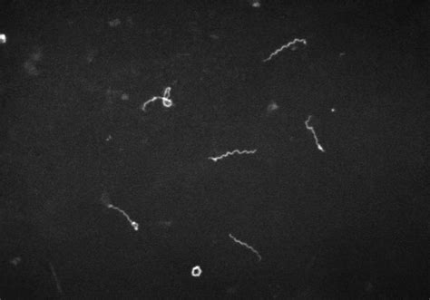 Dark Field Microscopy Was Invented (or Popularized) For The, 53% OFF