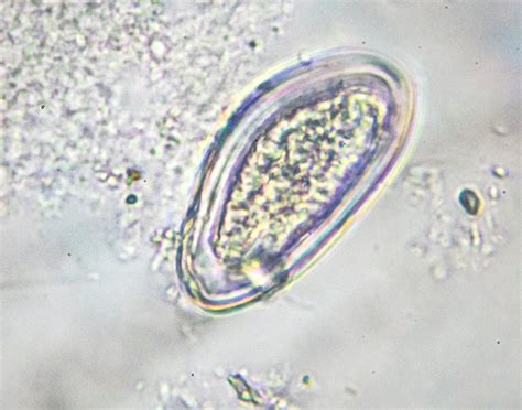 Pinworm test