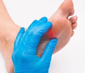 Caring for Chronic Podiatric Wounds - Hy-Tape International, Inc.