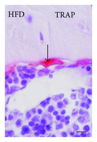 Microstructure of cancellous bone in demineralized paraffin sections ...