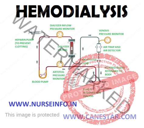 HEMODIALYSIS - Nurse Info