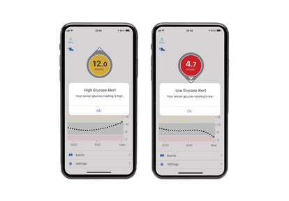 Dexcom G6 CGM – Glucose Monitoring System | Dexcom