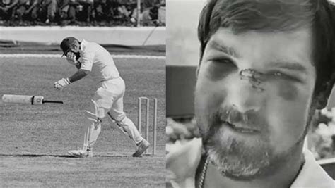 cricket sport injury | Mike Gatting's nose was smashed by a Malcolm Marshall bouncer © Getty ...