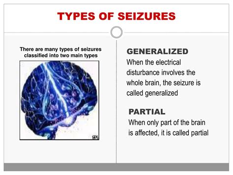 PPT - SEIZURES EPILEPSY PowerPoint Presentation, free download - ID:1465533