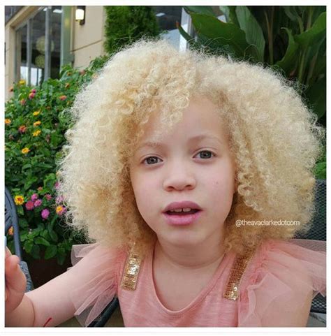 Pin by Usagi 🌙😝 on baby girl | Albino human, Albino african, White blonde hair
