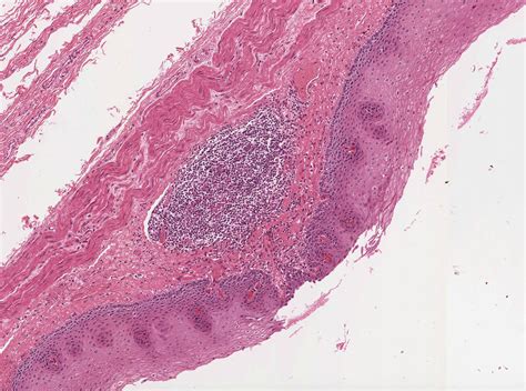 Pharynx, Esophagus, and Stomach | histology