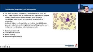 LGL Leukemia: History, Diagnosis, and Treatment Options | VuMedi