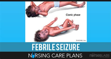 5 Benign Febrile Convulsions Nursing Care Plans | Nursing care plan ...