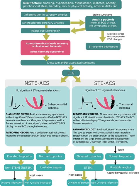 STEMI (ST Elevation Myocardial Infarction): diagnosis, criteria, ECG & management – ECG & ECHO