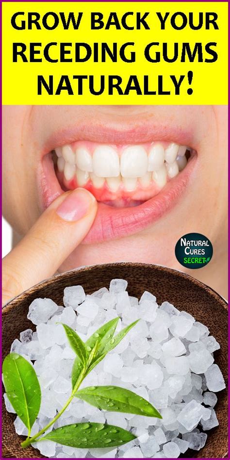 Pin on Dental Care | Oral Hygiene