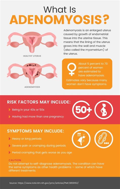 Adenomyosis: Enlarged Uterus Causes (+ Natural Relief) - Dr. Axe | Adenomyosis treatment, Uterus ...