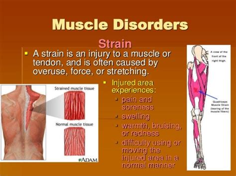 The muscle system disorder