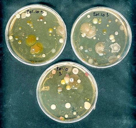 Bacteria in Soil: A Source of New Antibiotics | Owlcation