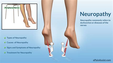 Neuropathy|Classification|Types|Causes|Risk Factors|Symptoms|Treatment ...