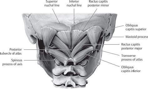 Craniovertebral Junction | Neupsy Key