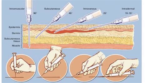 Types of Syringes and Needles - Gwaymedical.com - YouTube