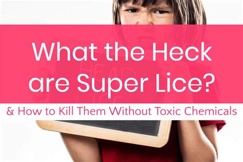 What On Earth Are Super Lice? (Plus How to Get Rid of Them Without ...