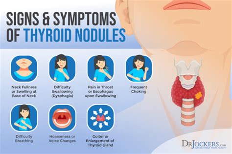 Thyroid Nodules: Symptoms, Causes, and Support Strategies