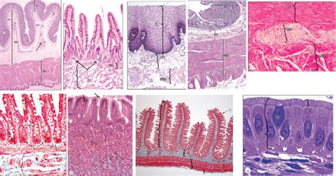 Histology of the GI Tract Diagram | Quizlet