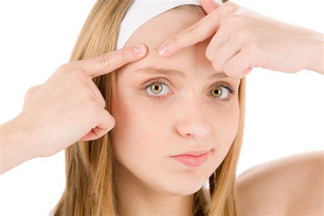 Two ultimate acne tips! Acne Skin, Skin Care Acne, Acne Scars, Skin Care Tips, Acne Facial ...