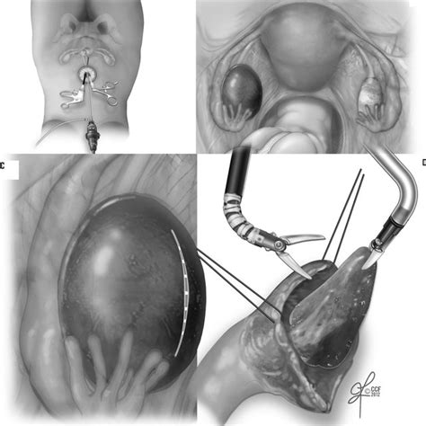 Stages of the ovariohysterectomy procedure whose durations were... | Download Scientific Diagram