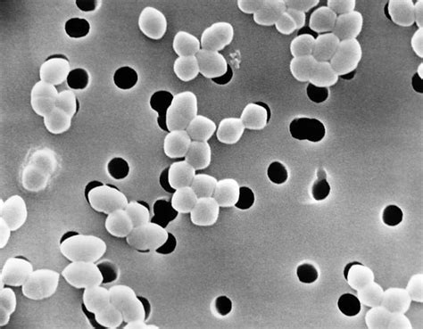 Enterococcus - wikidoc