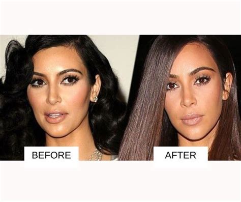 25 Most Popular Celebrities With Lip Fillers: Before And After With Images | Fabbon