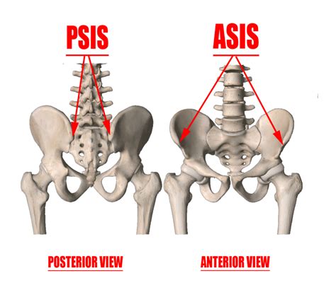 Posterior Iliac Horns