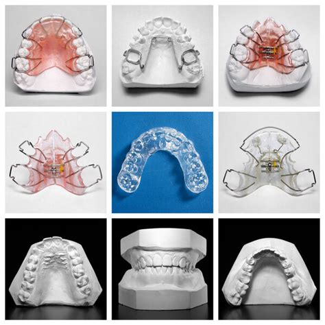 Adult Orthodontics Sterling | Orthodontics Treatment For Adults