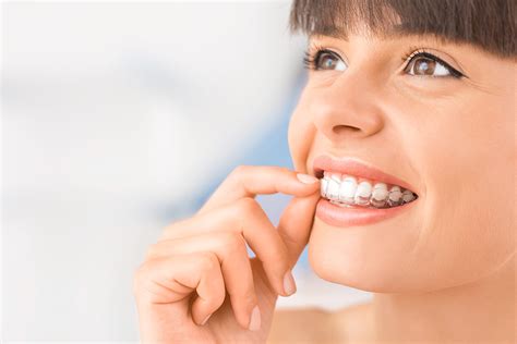 What to Expect With Invisalign Clear Aligners