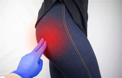 Gluteal Tendinopathy - Causes & Best Treatment Options in 2023