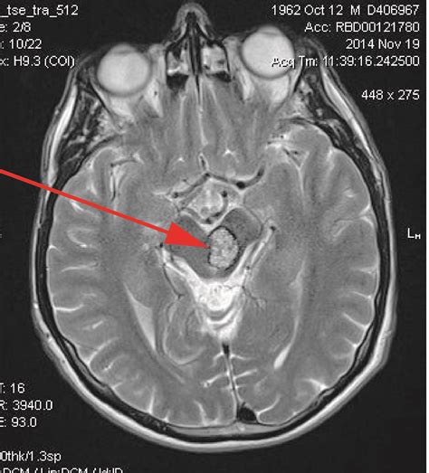 Stroke Medicine for Stroke Physicians and Neurologists