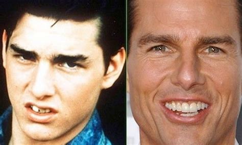 Tom Cruise Teeth Before - The Outsiders Star Tom Cruise Teeth Before ...