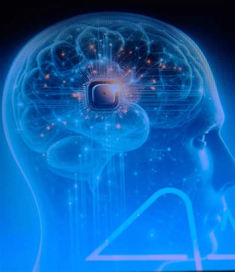 Neurologist explains how new brain chip Neuralink works - News - UNILAD ...