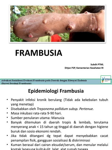 Penyakit Frambusia | PDF