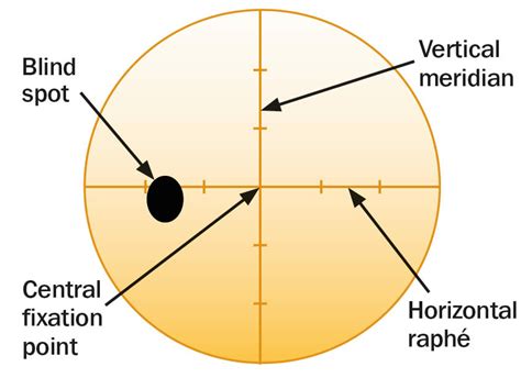 Community Eye Health Journal » Visual field testing for glaucoma – a practical guide