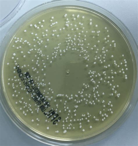 Lactobacillius plantarum growing on Lactobacillius MRS AGAR. | Microbiología, Bacteriologia, Química