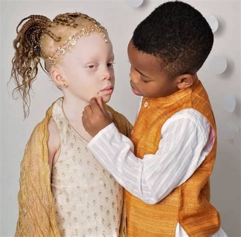 Twins With Different Skin Colors (15 pics)