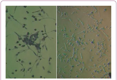 Left) hPB-SCs stained by Giemsa 5 days under microscope 200X; Right)... | Download Scientific ...