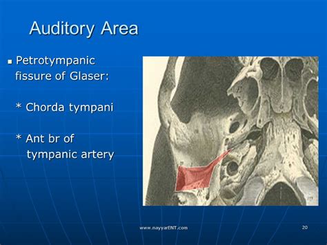 Surgical Anatomy of Skull Base Dr. Supreet Singh